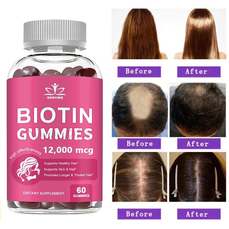 Hair Care Gummies - Kollagen-Gummis, Biotin-Gummis für die Hautpflege, Gesundheit,
