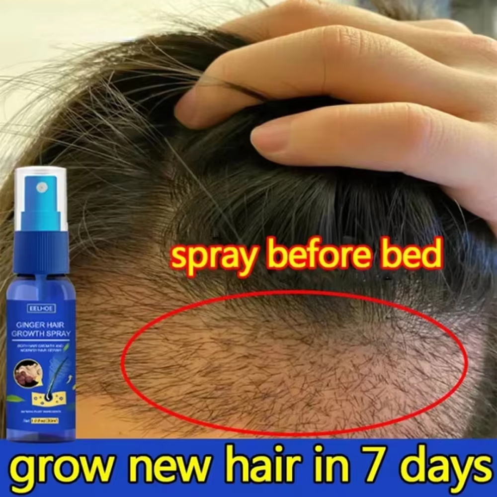Hair Care Serum - Schnelles Ingwer-Haarwuchsspray für Wurzelwachstum, Anti-Haarausfall, Haarwuchs-Serum,