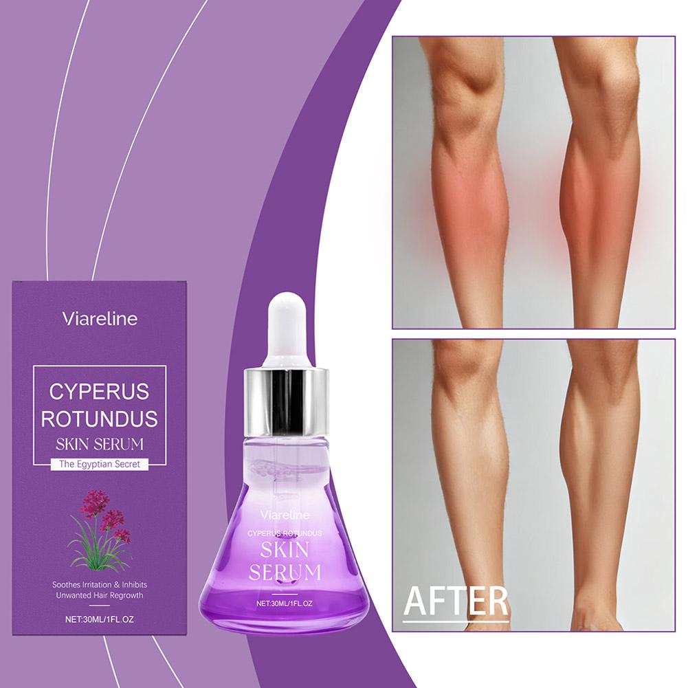Post-Haarentfernungs-Pflegeser – Hair Care Serum Bewertung und Preis